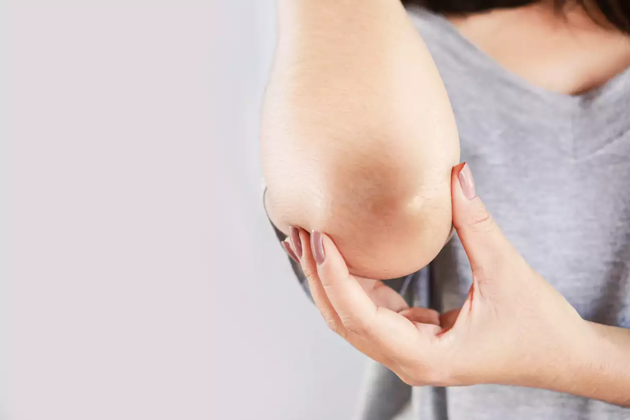 5 Tips to Lighten and Soften the Elbow Skin